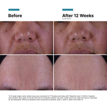 Load image into Gallery viewer, P-TIOX Anti-Wrinkle Cream